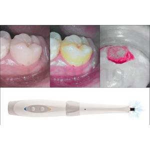 CAMARA DIAGNOSTICO SOPROCARE