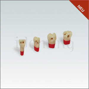 AG3ZSDPK.300V1 Nº26 c/esmalte dentina y pulpa c/caries 100ud