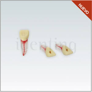 ANA4ZPUKN11 Diente endodoncia c/ raiz natural transparente