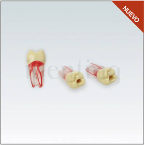 ANA4ZPUKN16 Diente endodoncia c/ raiz natural transparente