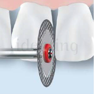 952.900.140 KOMET diamante clinica stripping