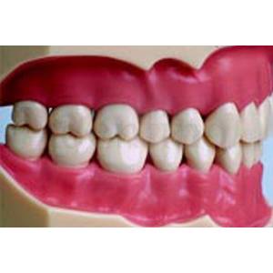 MODELO UNIVERSAL 32 DIENTES ENCIA BLAND