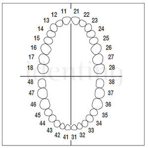AG3ZE0100 nº 23 dientes 100 ud
