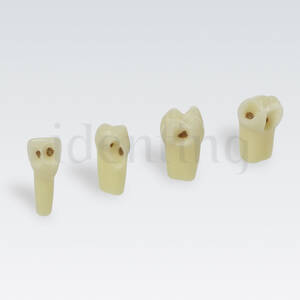 AG3ZSDK.300V1 24 diente c/esmalte, dentina c/caries