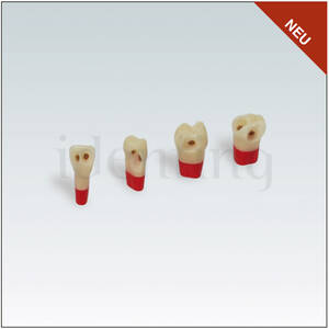 AG3ZSDPKN26 diente c/esmalte. dentina y pulpa c/caries
