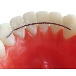 ALAMBRE trenzado p/retenedor lingual 010x028x150mm
