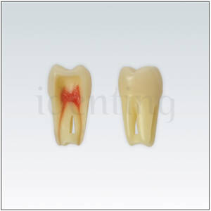 ANA4Z3RN26 diente endo c/raiz natural. apto RX. 3 capas nº26