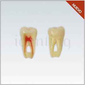 ANA4Z3RN46 diente endo c/raiz natural. apto RX. 3 capas n&ordm;46
