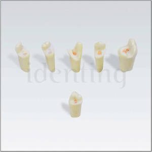ANA4ZE0100 n&ordm; 47 dientes 100 ud