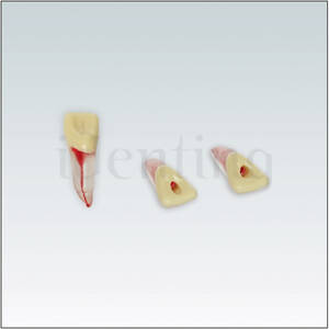 ANA4ZPUKN21 Diente endodoncia c/ raiz natural transparente