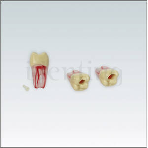 ANA4ZPUKN26 Diente endodoncia c/ raiz natural transparente