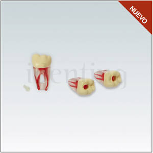 ANA4ZPUKN36 Diente endodoncia c/ raiz natural transparente