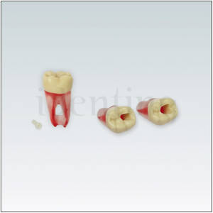 ANA4ZPUKN46 Diente endodoncia c/ raiz natural transparente