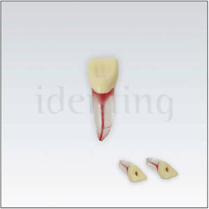 ANA4ZPUKNTT26 Diente endodoncia c/raiz natural transparente