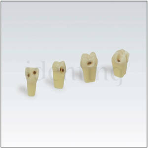ANA4ZSDK.301V1 N&ordm;46 diente esmalte-dentina c/caries