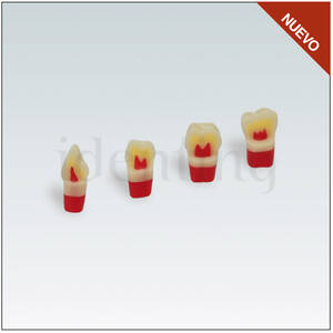 ANA4ZSDP21300 Nº21 diente esmalte-dentina-pulpa
