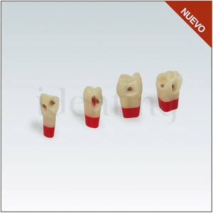 ANA4ZSDPK Nº21 diente esmalte-dentina-pulpa c/caries