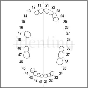 AOPZE MS 24 diente c/raiz p/reseccion