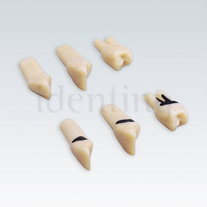 APZZEC1 nº 26 dientes especiales 1 raiz con sarro