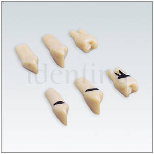 APZZEC2 nº 47 dientes 2 raices con sarro