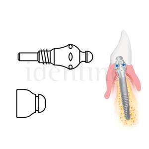 MICROPLANT KOMET 4305A.0 kit anclaje anillo