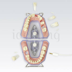 MODELO AREEMZ3RN901 p/radiografia y conductometria